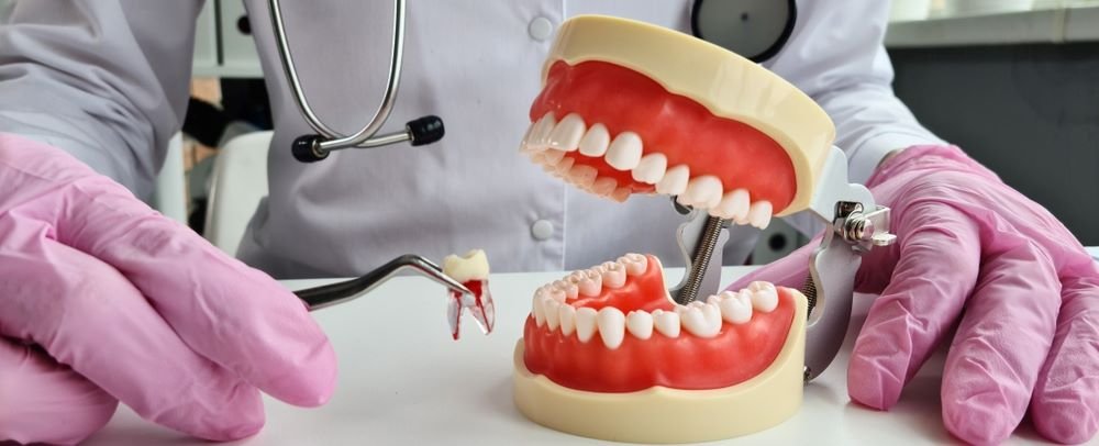 Tooth Extraction